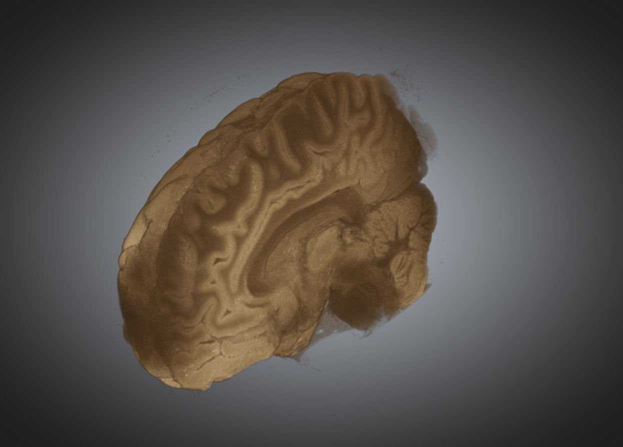 MRI
